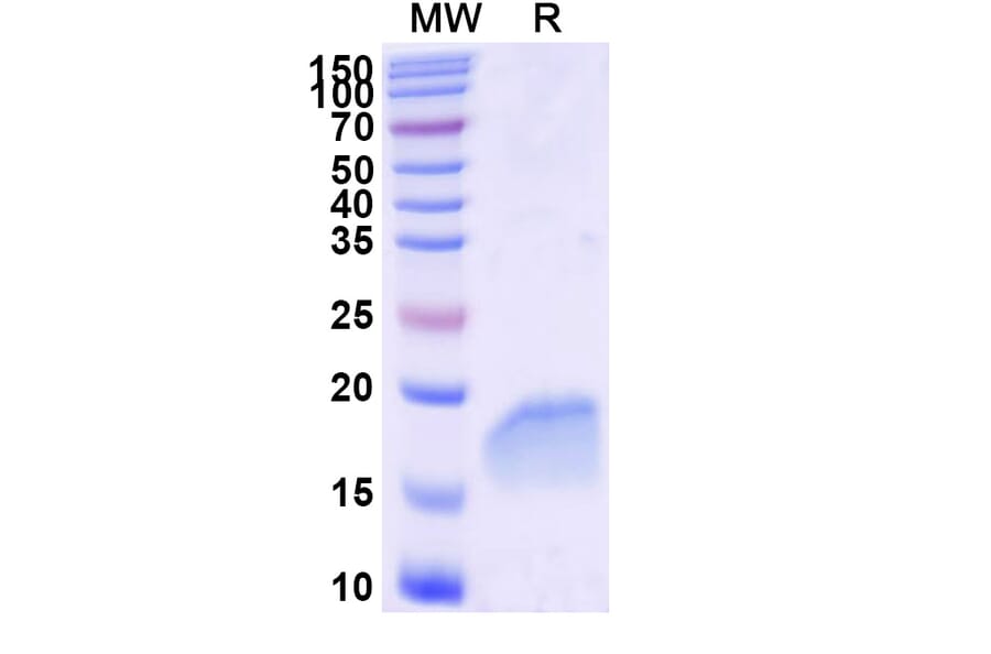 SDS-PAGE - Anti-PTRF Nanobody [SAA2295] (A338393) - Antibodies.com