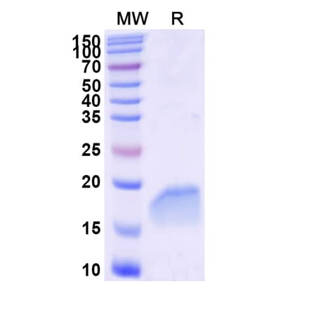SDS-PAGE - Anti-PTRF Nanobody [SAA2295] (A338393) - Antibodies.com