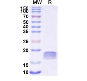 SDS-PAGE - Anti-TTYH2 Nanobody [SAA2300] (A338395) - Antibodies.com