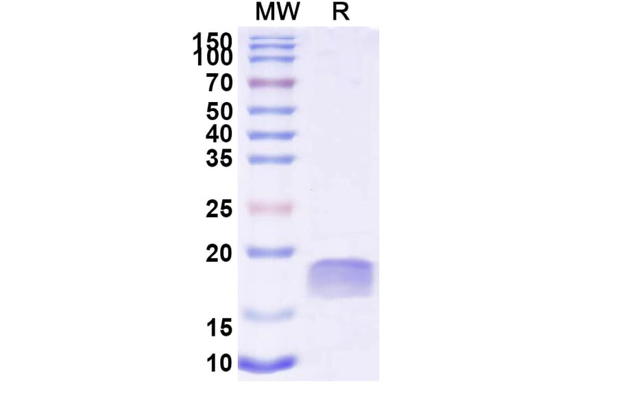 SDS-PAGE - Anti-TTYH2 Nanobody [SAA2300] (A338395) - Antibodies.com