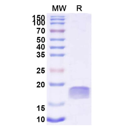 SDS-PAGE - Anti-TTYH2 Nanobody [SAA2300] (A338395) - Antibodies.com