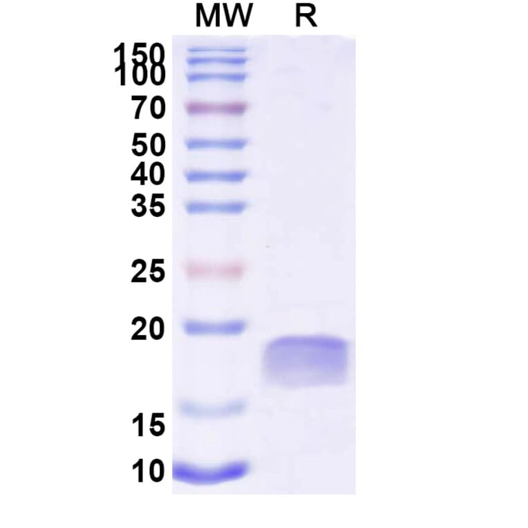 SDS-PAGE - Anti-TTYH2 Nanobody [SAA2300] (A338395) - Antibodies.com