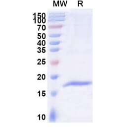 SDS-PAGE - Anti-DARC Nanobody [SAA2301] (A338396) - Antibodies.com
