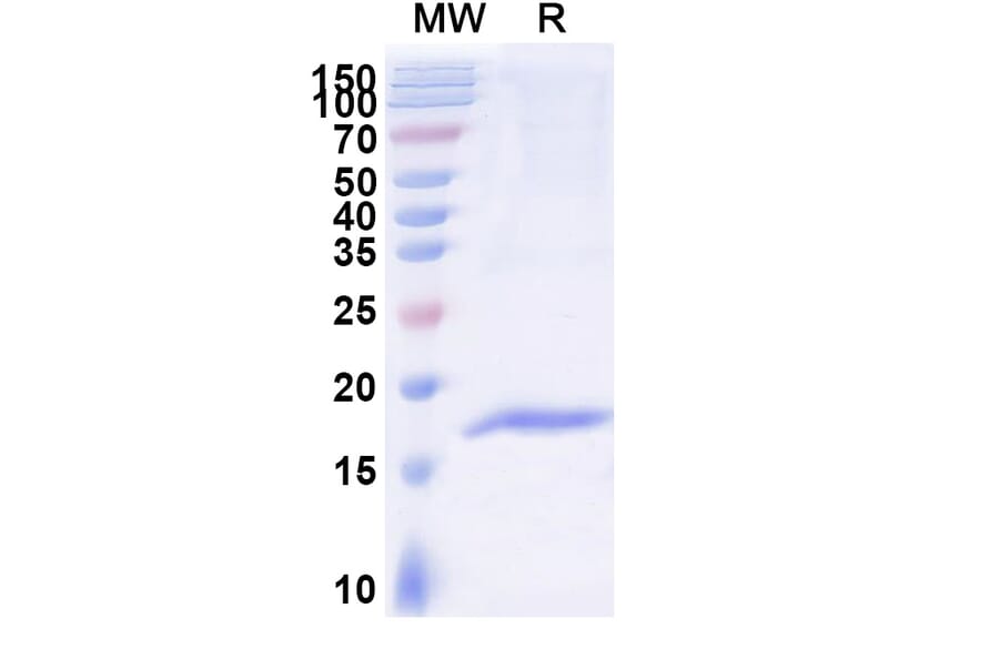 SDS-PAGE - Anti-DARC Nanobody [SAA2301] (A338396) - Antibodies.com