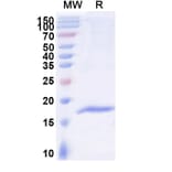 SDS-PAGE - Anti-DARC Nanobody [SAA2301] (A338396) - Antibodies.com