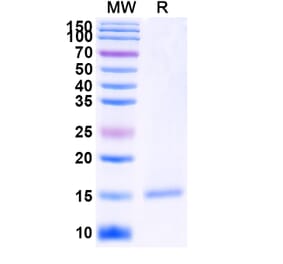 SDS-PAGE - Anti-PSMA Nanobody [SAA2305] (A338397) - Antibodies.com