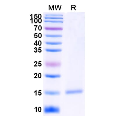 SDS-PAGE - Anti-PSMA Nanobody [SAA2305] (A338397) - Antibodies.com