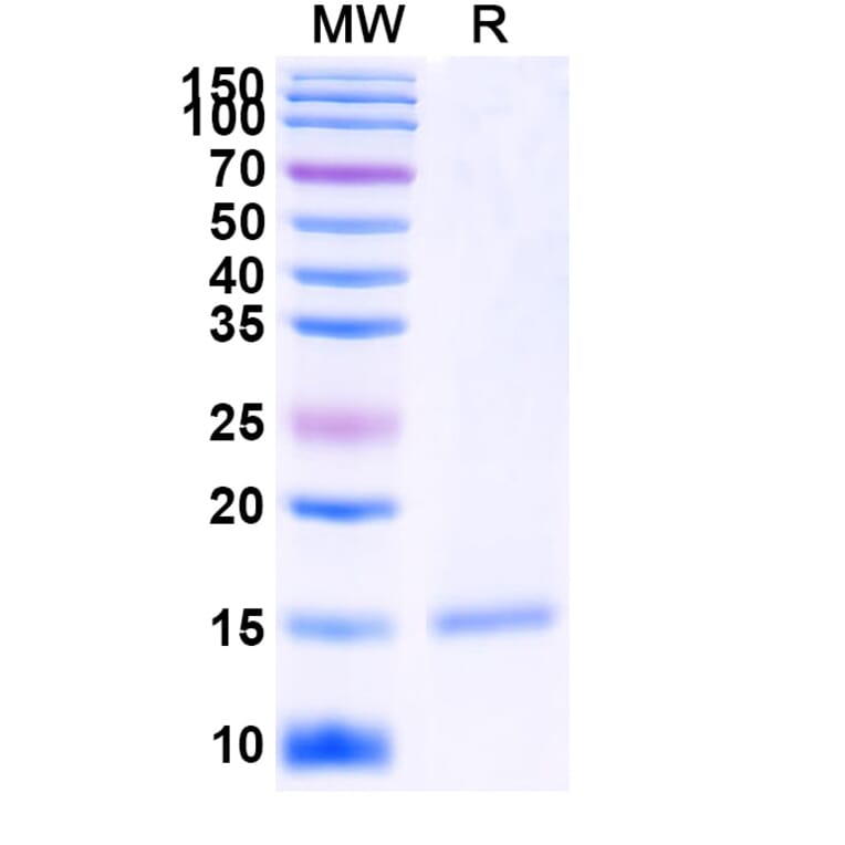 SDS-PAGE - Anti-PSMA Nanobody [SAA2305] (A338397) - Antibodies.com