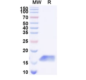 SDS-PAGE - Anti-Galectin 1 Nanobody [SAA2310] (A338400) - Antibodies.com