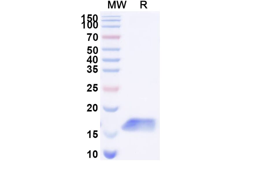 SDS-PAGE - Anti-Galectin 1 Nanobody [SAA2310] (A338400) - Antibodies.com