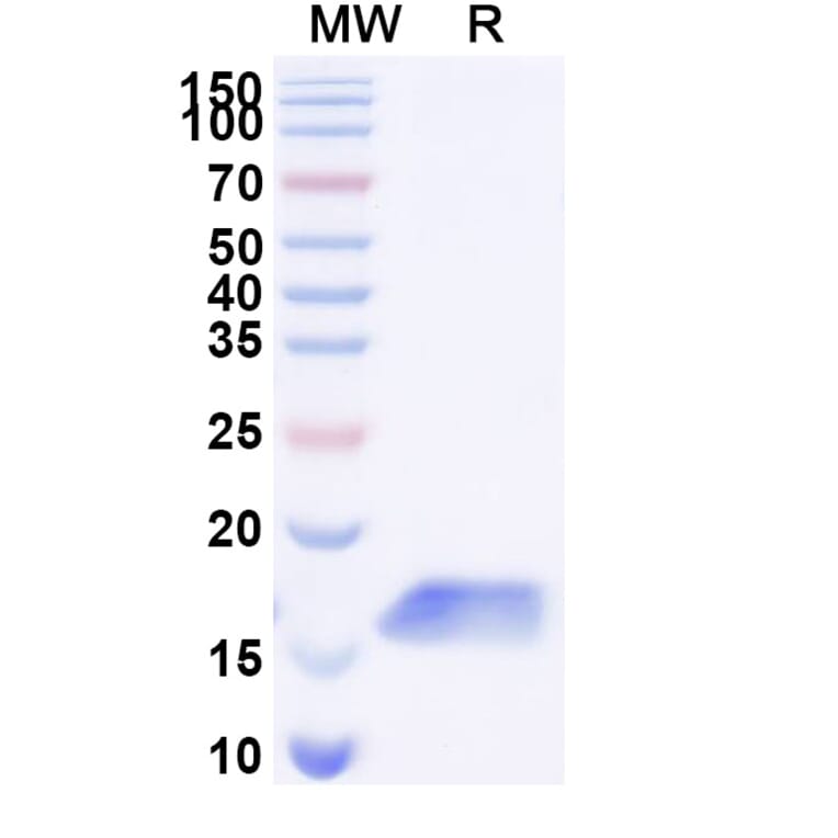 SDS-PAGE - Anti-Galectin 1 Nanobody [SAA2310] (A338400) - Antibodies.com