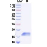 SDS-PAGE - Anti-Galectin 1 Nanobody [SAA2310] (A338400) - Antibodies.com