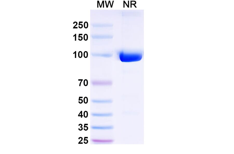 SDS-PAGE - Anti-Nav1.4 + Nav1.5 Nanobody [SAA2316] (A338401) - Antibodies.com