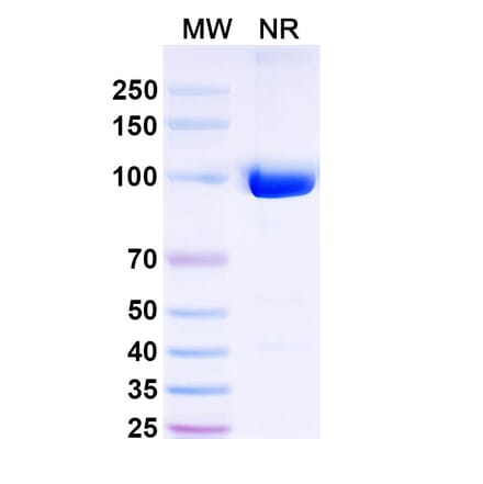 SDS-PAGE - Anti-Nav1.4 + Nav1.5 Nanobody [SAA2316] (A338401) - Antibodies.com
