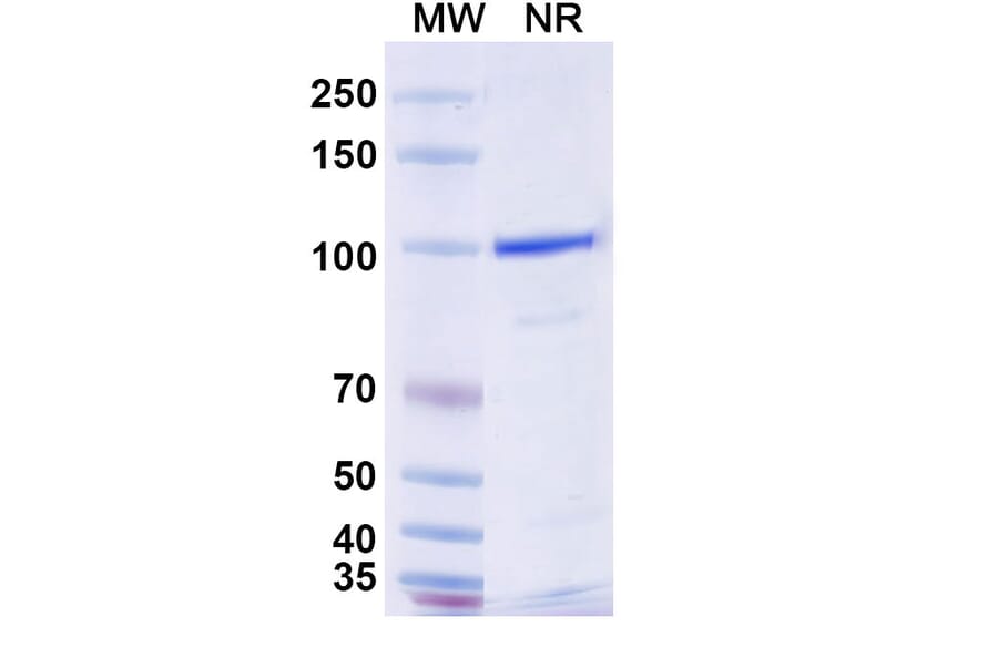 SDS-PAGE - Anti-Nav1.4 + Nav1.5 Nanobody [SAA2317] (A338402) - Antibodies.com