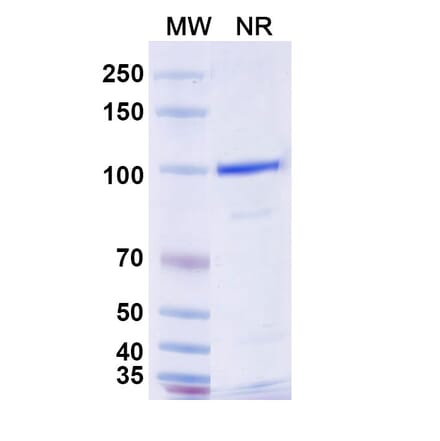 SDS-PAGE - Anti-Nav1.4 + Nav1.5 Nanobody [SAA2317] (A338402) - Antibodies.com