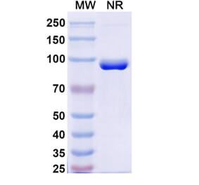 SDS-PAGE - Anti-FZD3 Nanobody [SAA2318] (A338403) - Antibodies.com