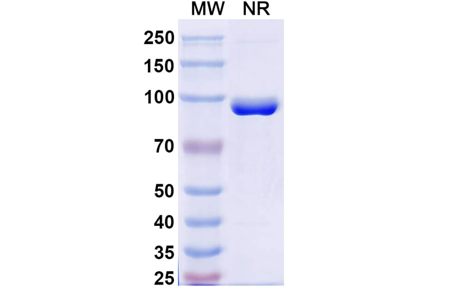 SDS-PAGE - Anti-FZD3 Nanobody [SAA2318] (A338403) - Antibodies.com