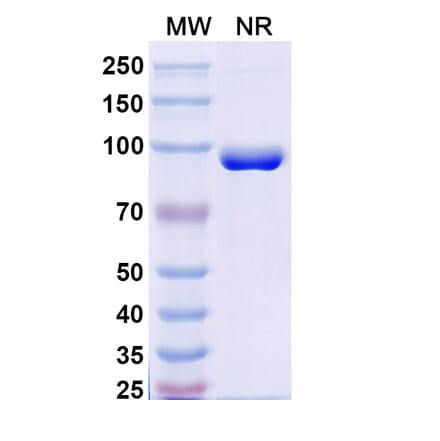 SDS-PAGE - Anti-FZD3 Nanobody [SAA2318] (A338403) - Antibodies.com
