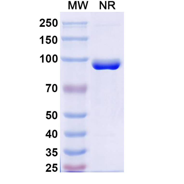 SDS-PAGE - Anti-FZD3 Nanobody [SAA2318] (A338403) - Antibodies.com