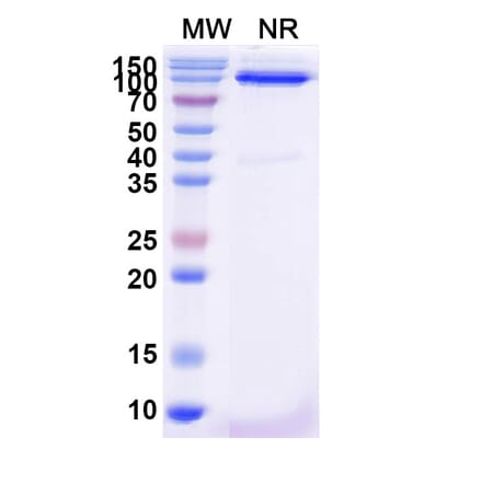 SDS-PAGE - Anti-FZD3 Nanobody [SAA2319] (A338404) - Antibodies.com