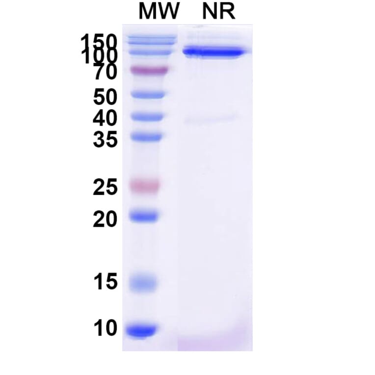 SDS-PAGE - Anti-FZD3 Nanobody [SAA2319] (A338404) - Antibodies.com