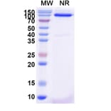 SDS-PAGE - Anti-FZD3 Nanobody [SAA2319] (A338404) - Antibodies.com