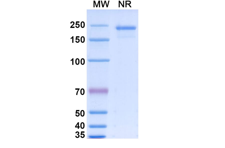 SDS-PAGE - Gevokizumab Biosimilar - Anti-IL-1 beta Antibody - BSA and Azide free (A338414) - Antibodies.com
