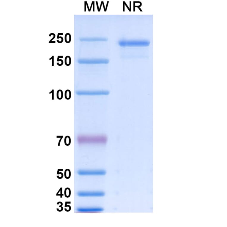 SDS-PAGE - Gevokizumab Biosimilar - Anti-IL-1 beta Antibody - BSA and Azide free (A338414) - Antibodies.com