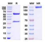 SDS-PAGE - Ziltivekimab Biosimilar - Anti-IL-6 Antibody - BSA and Azide free (A338416) - Antibodies.com