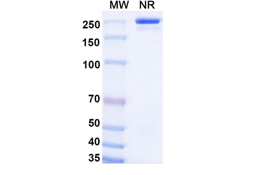 SDS-PAGE - Olokizumab Biosimilar - Anti-IL-6 Antibody - BSA and Azide free (A338418) - Antibodies.com