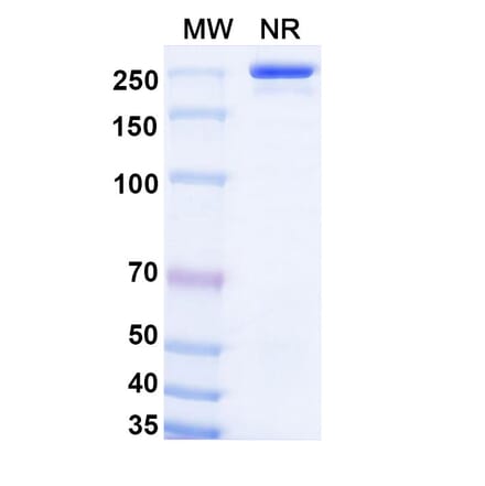SDS-PAGE - Olokizumab Biosimilar - Anti-IL-6 Antibody - BSA and Azide free (A338418) - Antibodies.com