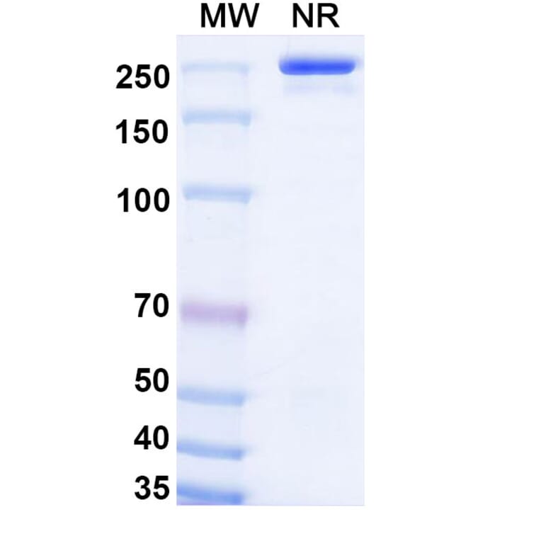 SDS-PAGE - Olokizumab Biosimilar - Anti-IL-6 Antibody - BSA and Azide free (A338418) - Antibodies.com