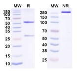 SDS-PAGE - Clazakizumab Biosimilar - Anti-IL-6 Antibody - BSA and Azide free (A338419) - Antibodies.com