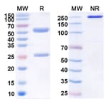 SDS-PAGE - Elsilimomab Biosimilar - Anti-IL-6 Antibody - BSA and Azide free (A338420) - Antibodies.com