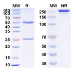 SDS-PAGE - Vunakizumab Biosimilar - Anti-IL-17A Antibody - BSA and Azide free (A338431) - Antibodies.com