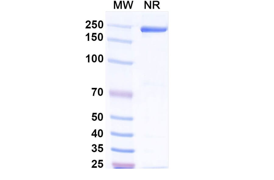 SDS-PAGE - Afelimomab Biosimilar - Anti-TNF alpha Antibody - BSA and Azide free (A338448) - Antibodies.com