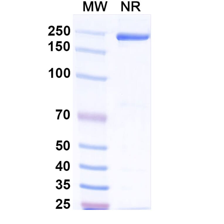 SDS-PAGE - Afelimomab Biosimilar - Anti-TNF alpha Antibody - BSA and Azide free (A338448) - Antibodies.com