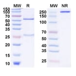 SDS-PAGE - Carlumab Biosimilar - Anti-MCP 1 Antibody - BSA and Azide free (A338471) - Antibodies.com