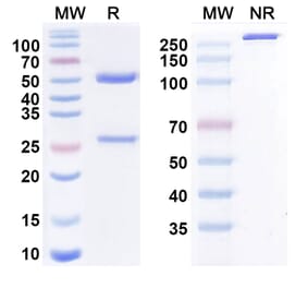 SDS-PAGE - Quetmolimab Biosimilar - Anti-CX3CL1 Antibody - BSA and Azide free (A338473) - Antibodies.com