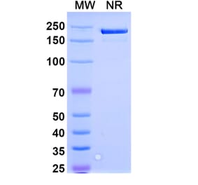 SDS-PAGE - Spesolimab Biosimilar - Anti-IL-36RN Antibody - BSA and Azide free (A338477) - Antibodies.com