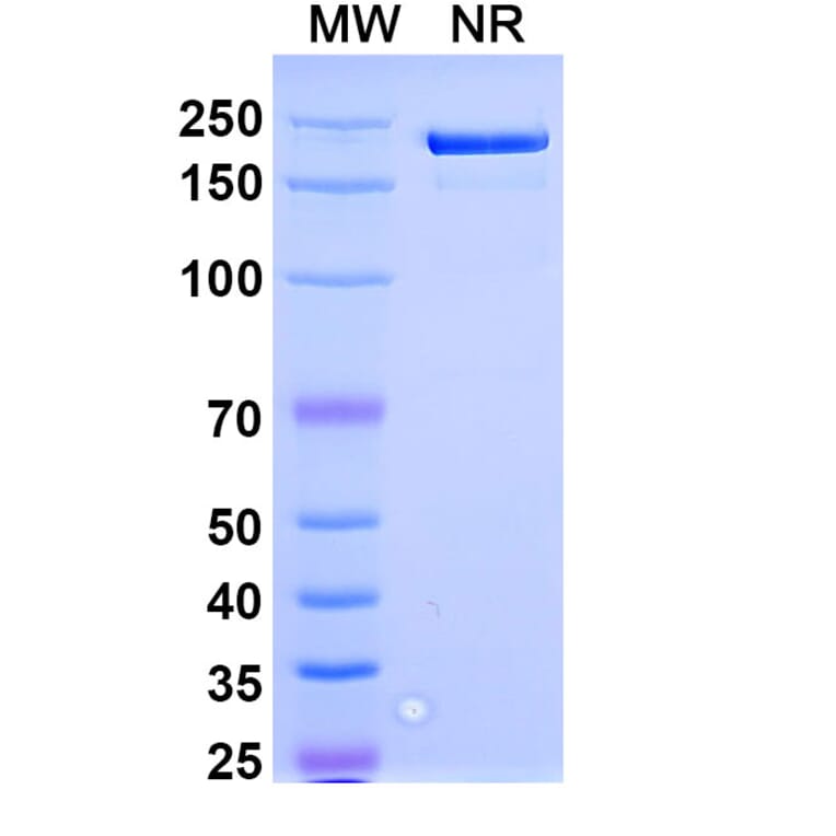 SDS-PAGE - Spesolimab Biosimilar - Anti-IL-36RN Antibody - BSA and Azide free (A338477) - Antibodies.com