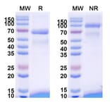 SDS-PAGE - Tebentafusp Biosimilar - Anti-CD3 epsilon Antibody - BSA and Azide free (A338484) - Antibodies.com