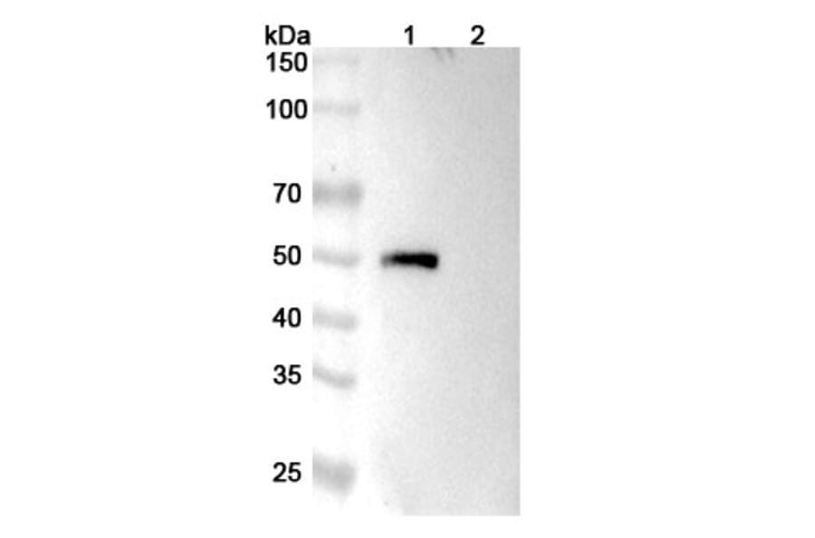 SDS-PAGE - Tregalizumab Biosimilar - Anti-CD4 Antibody - BSA and Azide free (A338486) - Antibodies.com