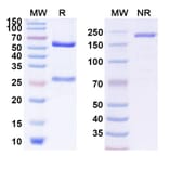 SDS-PAGE - Tregalizumab Biosimilar - Anti-CD4 Antibody - BSA and Azide free (A338486) - Antibodies.com