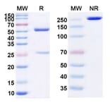 SDS-PAGE - Cedelizumab Biosimilar - Anti-CD4 Antibody - BSA and Azide free (A338487) - Antibodies.com