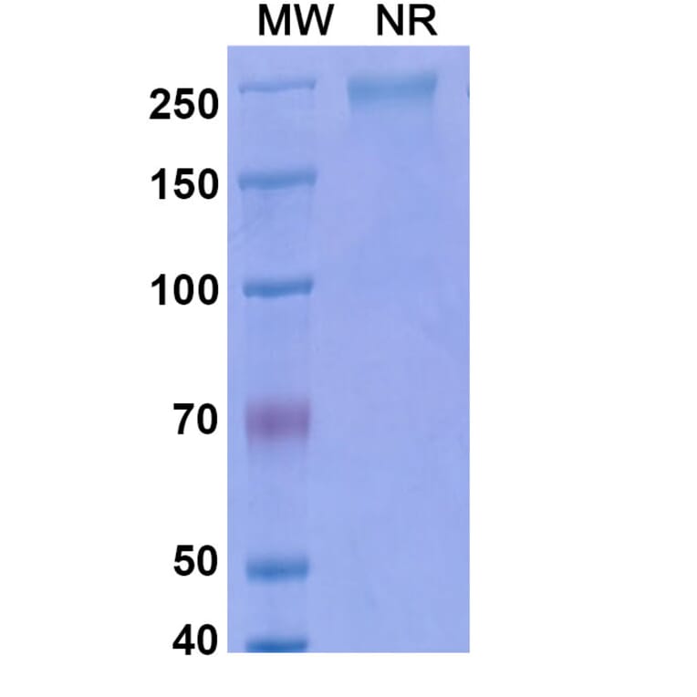 SDS-PAGE - Keliximab Biosimilar - Anti-CD4 Antibody - BSA and Azide free (A338489) - Antibodies.com