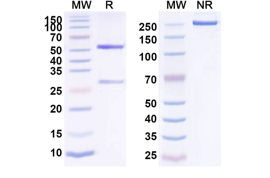 SDS-PAGE - Zolimomab Biosimilar - Anti-CD5 Antibody - BSA and Azide free (A338491) - Antibodies.com