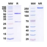 SDS-PAGE - Zolimomab Biosimilar - Anti-CD5 Antibody - BSA and Azide free (A338491) - Antibodies.com