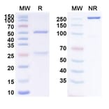SDS-PAGE - Itolizumab Biosimilar - Anti-CD6 Antibody - BSA and Azide free (A338493) - Antibodies.com